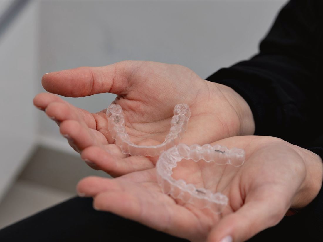 Manos sosteniendo dos alineadores transparentes en la clínica